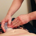 Abdominal Cupping…Seriously?